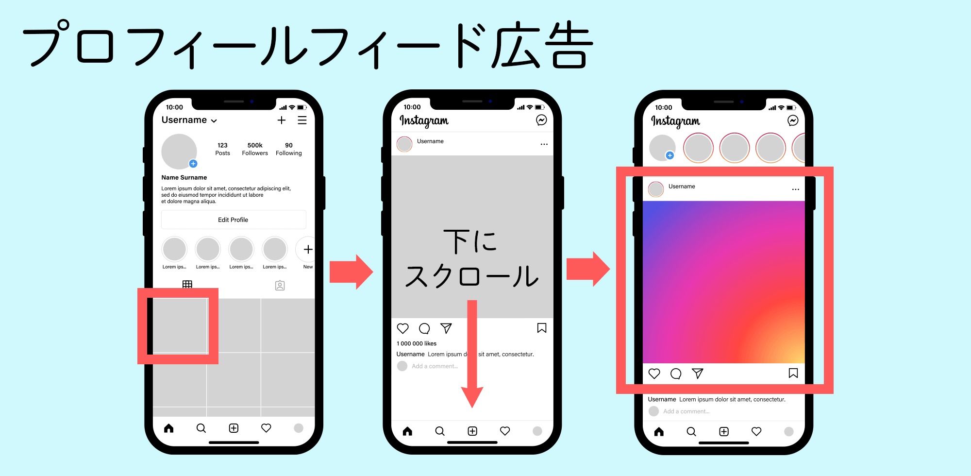 プロフィールフィード広告